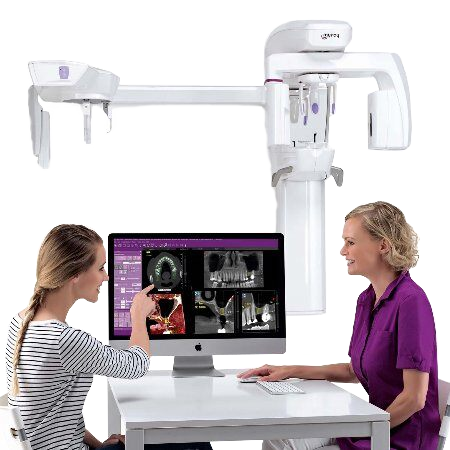 OPG – Ct-dent